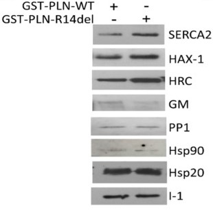 Pulldown assays using PLN-WT or PLN-R14del.jpg